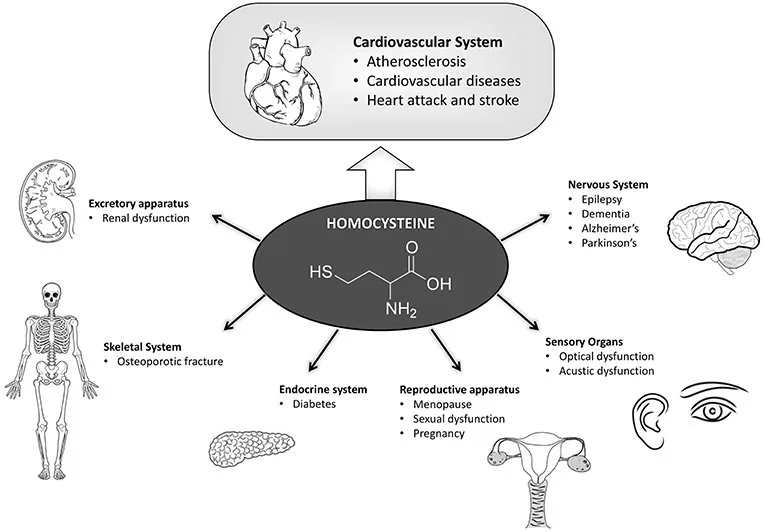 Illustration from The Hidden Molecule Driving Inflammation: Understanding the Purser Model of Homocysteine